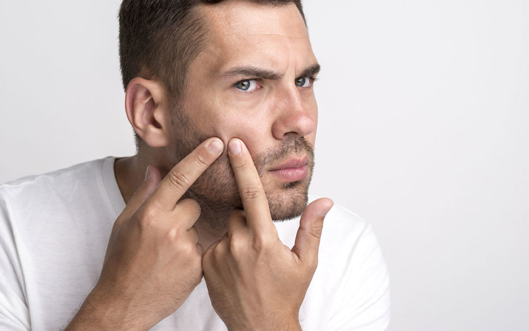 Les solutions contre les boutons sous la barbe